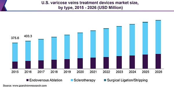 美国静脉曲张治疗设备市场规模