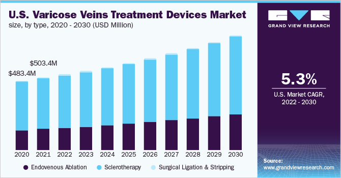 2020 - 2030年美国静脉曲张治疗设备市场规模、类型(百万美元)